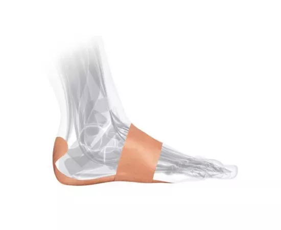 جوارب التهاب التهاب اللفافة الأخمصية من مويلر 0.22رطل