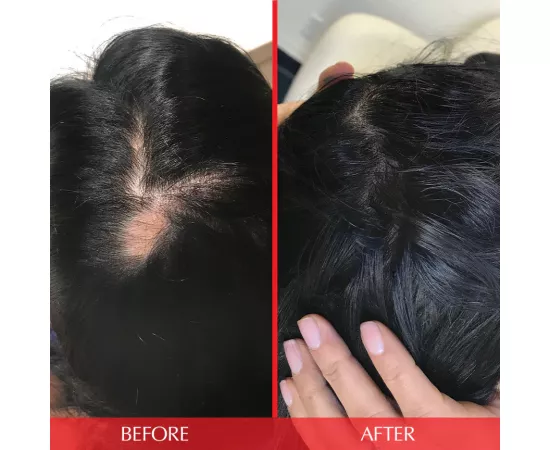 HAIRtamin Advanced Formula Capsules 30's