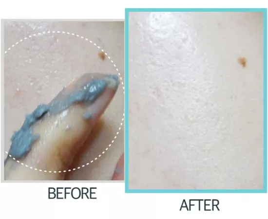 قناع جل أسود سكراب و مقشر من  ميشن كومبليت توطش إن سول - 120 مل